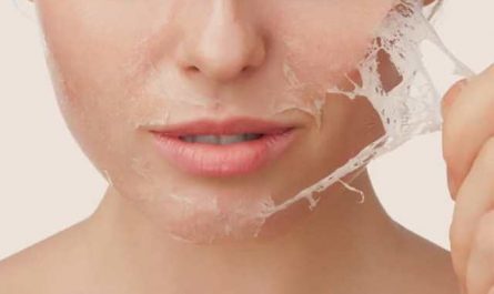 Pourquoi rêver de peau qui pèle ou se décolle ?
