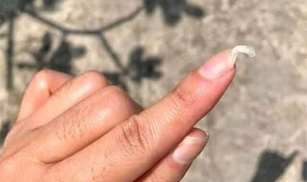 Pourquoi rêver d'ongle tombé ?