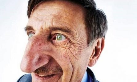 Pourquoi rêver de gros nez ?