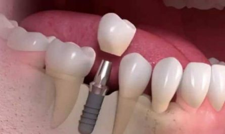 Pourquoi rêver de vis dans la bouche ?