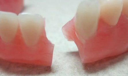 Pourquoi rêver de dentier cassé en deux?