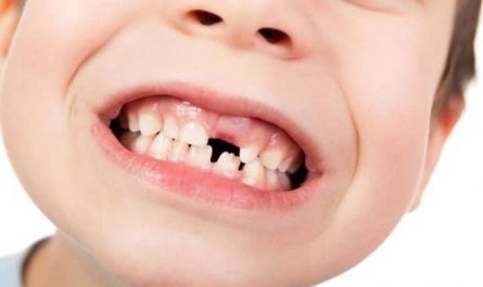 Pourquoi rêver de dents de lait ?