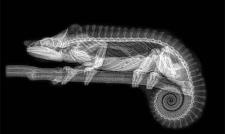 Pourquoi rêver de radiographie ?