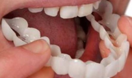 Pourquoi rêver de fausses dents ?