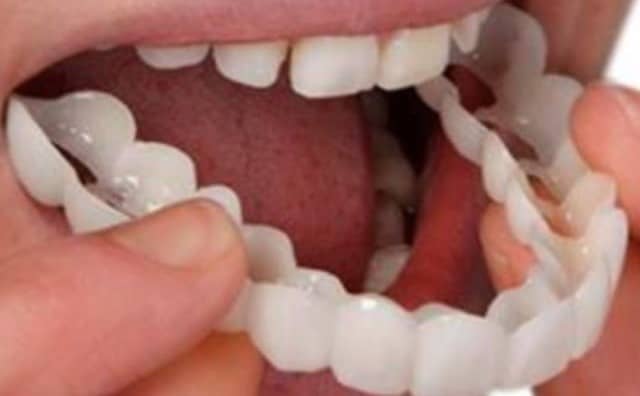 Pourquoi rêver de fausses dents ?