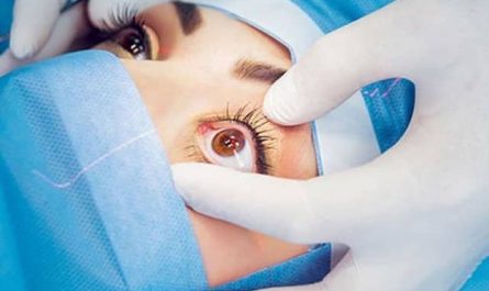 Pourquoi rêver de se faire opérer des yeux ?