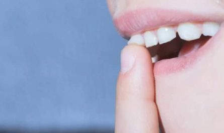 Pourquoi rêver de dents molles ?
