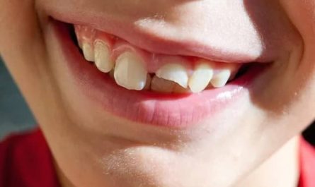 Pourquoi rêver d'une dent de devant cassée ?