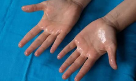 Pourquoi rêver de mains moites ?