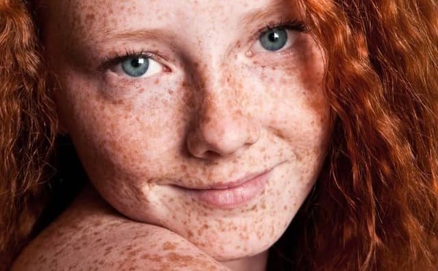 Rêver d’un visage avec des taches de rousseur