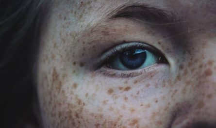 Pourquoi rêver de taches de rousseur ?
